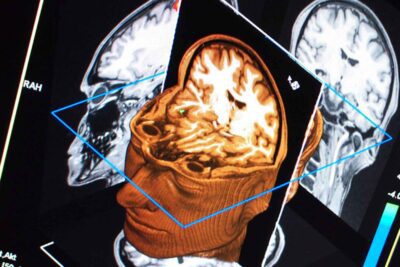 Función cerebral y partes involucradas en el pensamiento