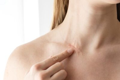 Cómo reconocer y manejar los síntomas comunes de estrés y ansiedad